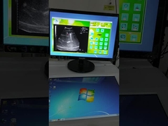 Vaste golfbron Extracorporale schokgolf Lithotripsie machine Ultrasone locatie systeem