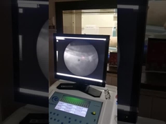 Hoog nauwkeurige extracorporale schokgolfmachine.